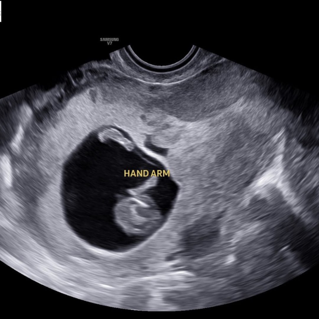 Photo shared by Samantha for their Babylist baby registry.