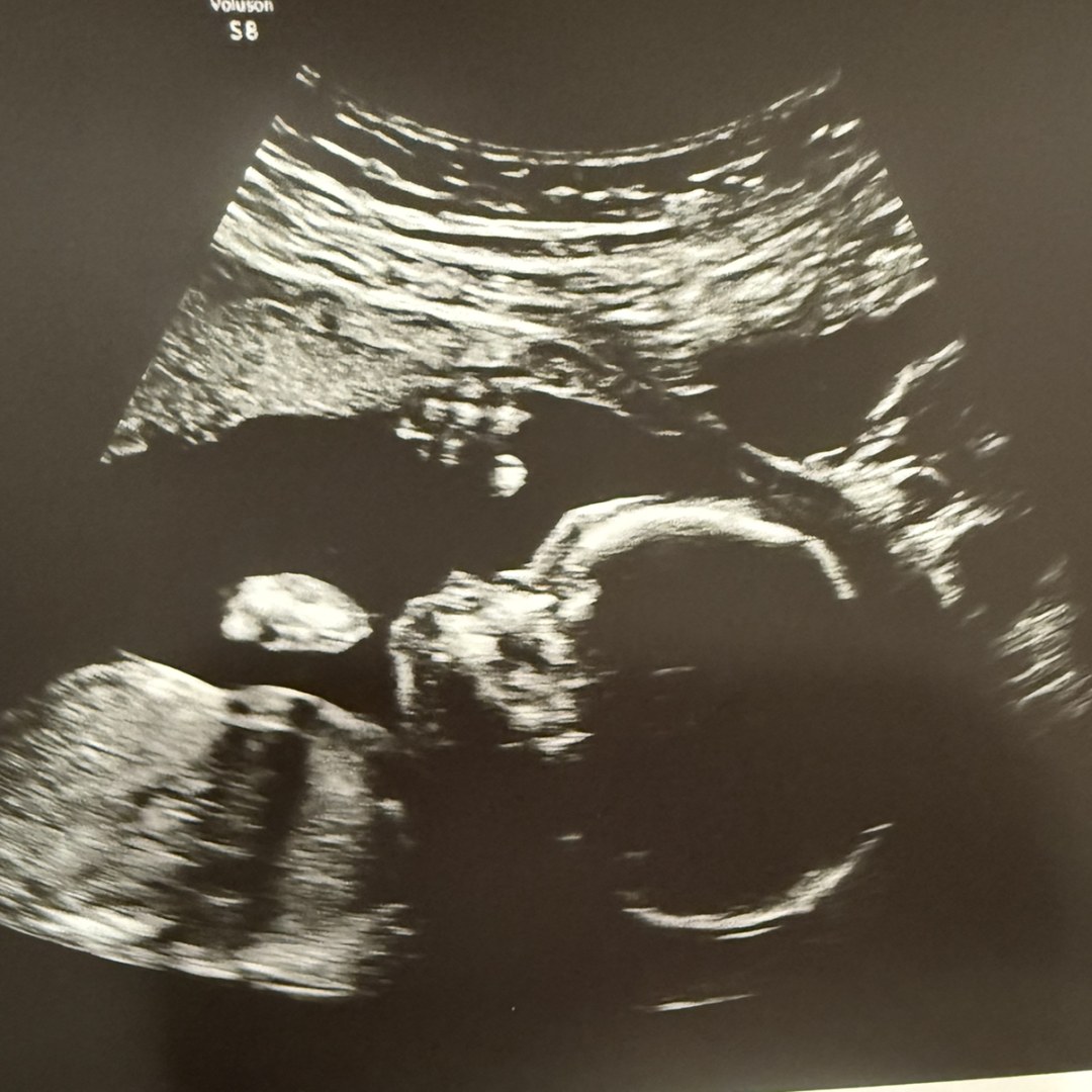 Photo shared by Brooke for their Babylist baby registry.
