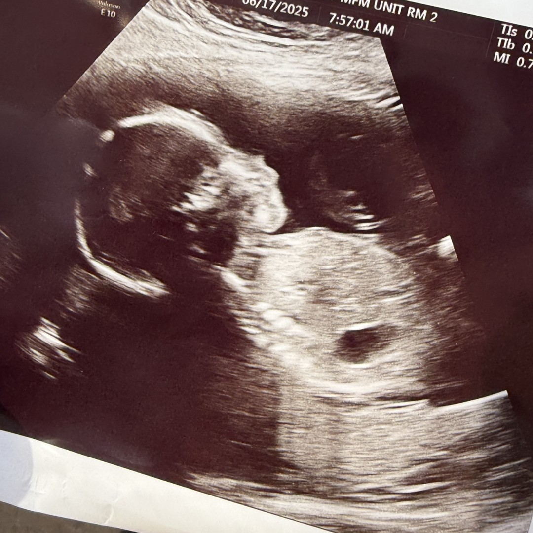 Photo shared by Jenny for their Babylist baby registry.