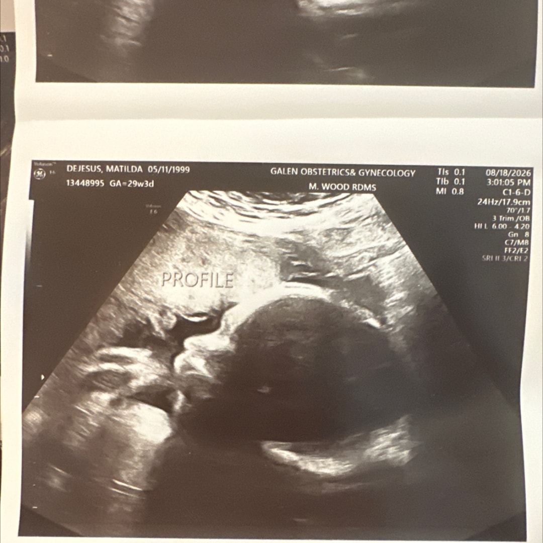 Photo shared by Matilda for their Babylist baby registry.