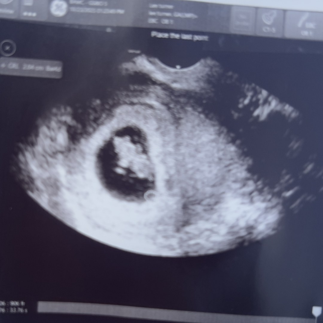 Photo shared by Imani for their Babylist baby registry.