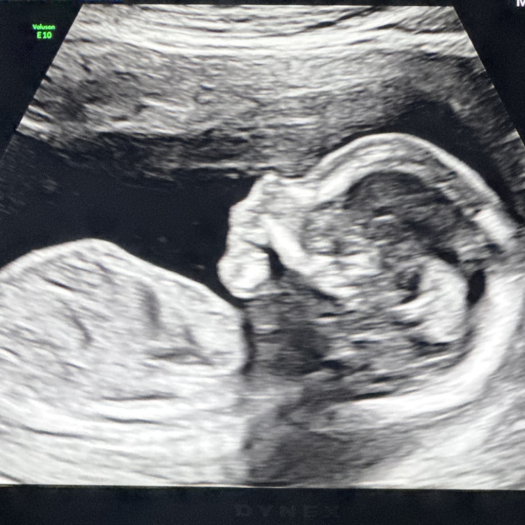 Photo shared by Jessica for their Babylist baby registry.