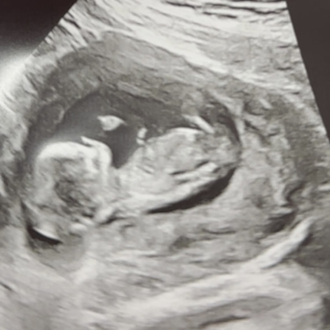 Photo shared by Aaron for their Babylist baby registry.