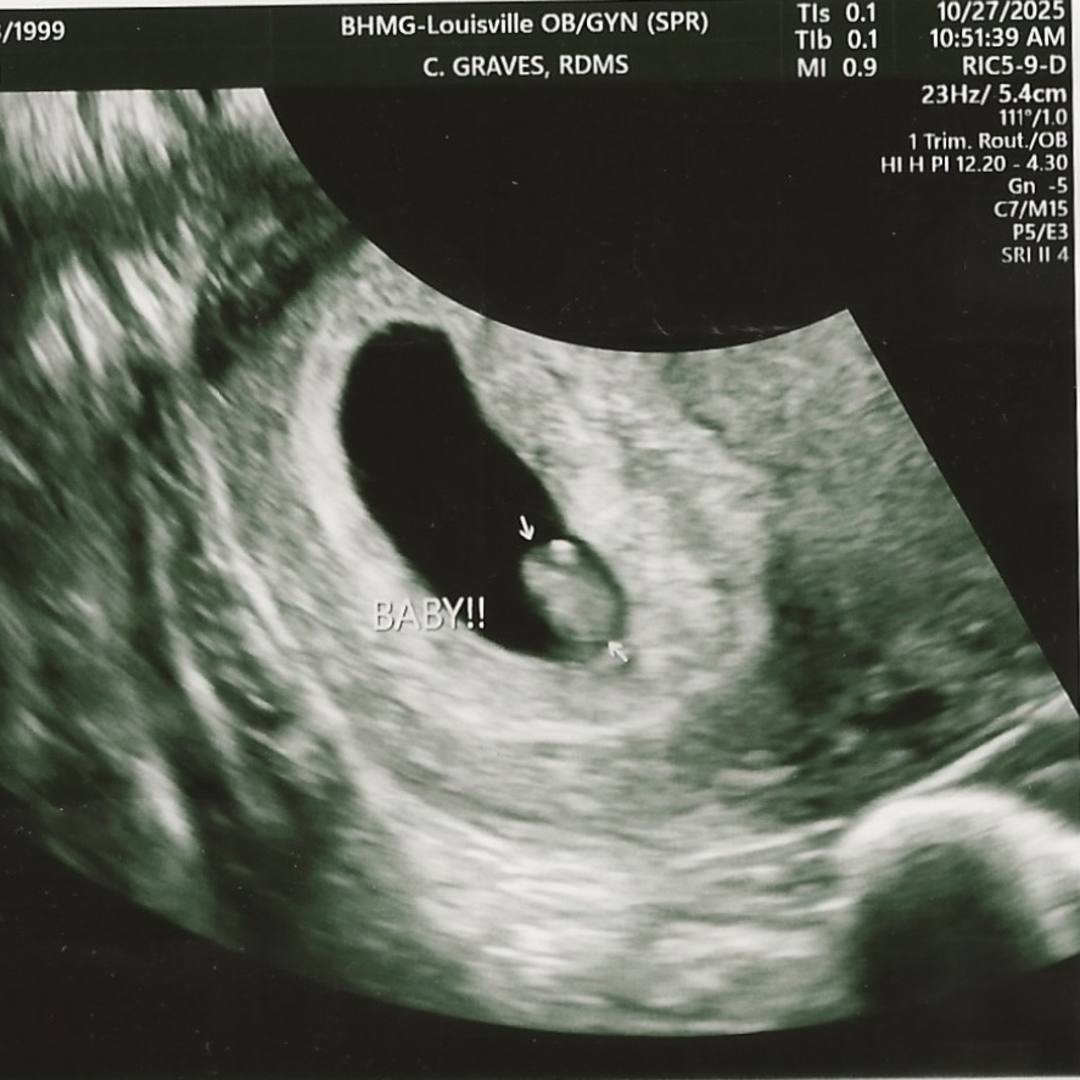 Photo shared by Hailee for their Babylist baby registry.