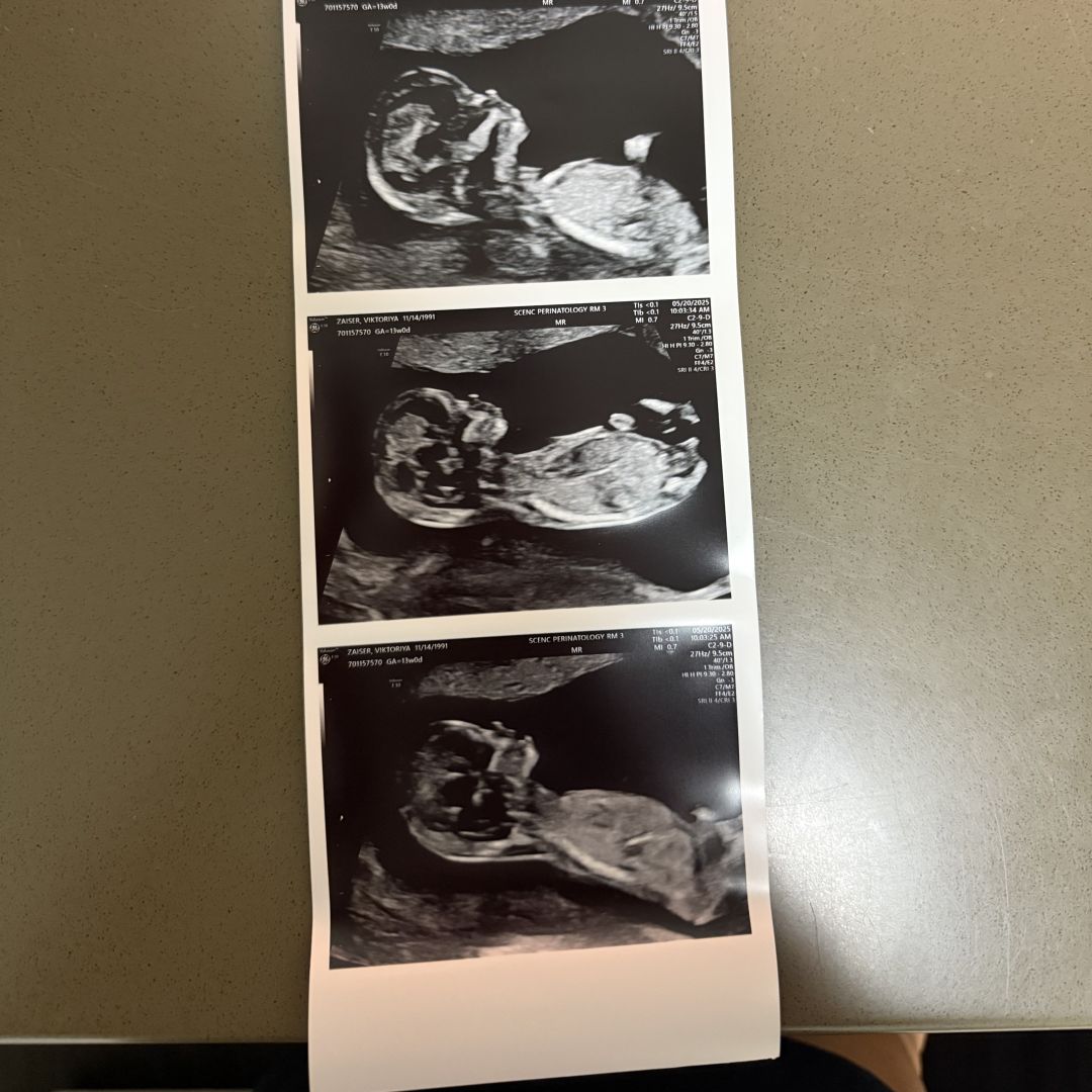 Photo shared by Viktoriya for their Babylist baby registry.