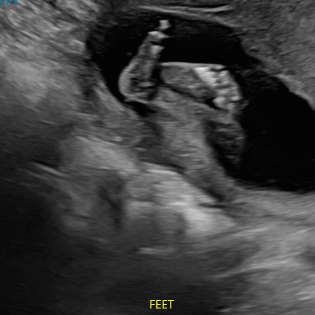 Photo shared by Iliana for their Babylist baby registry.