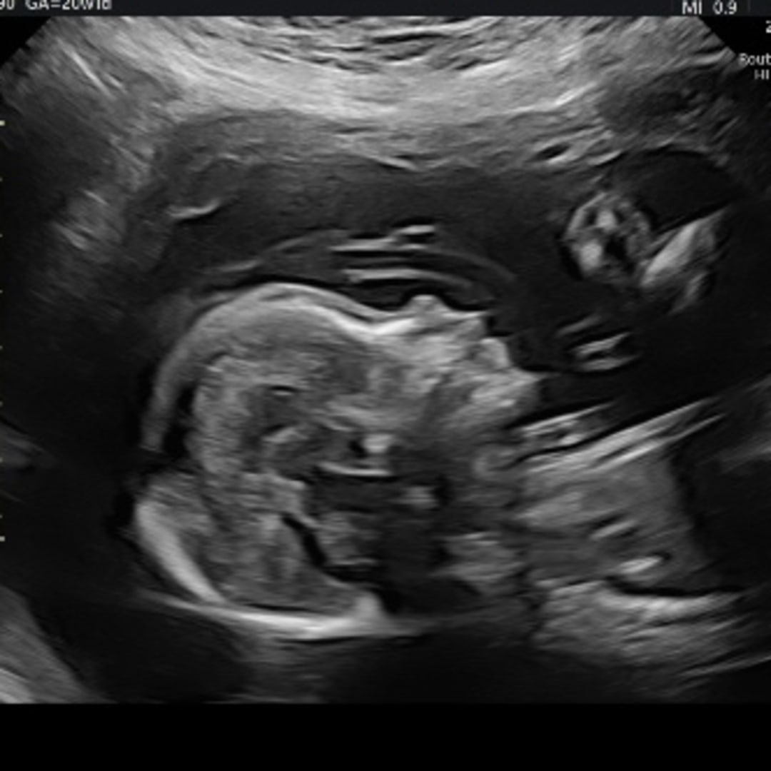 Photo shared by Lina for their Babylist baby registry.