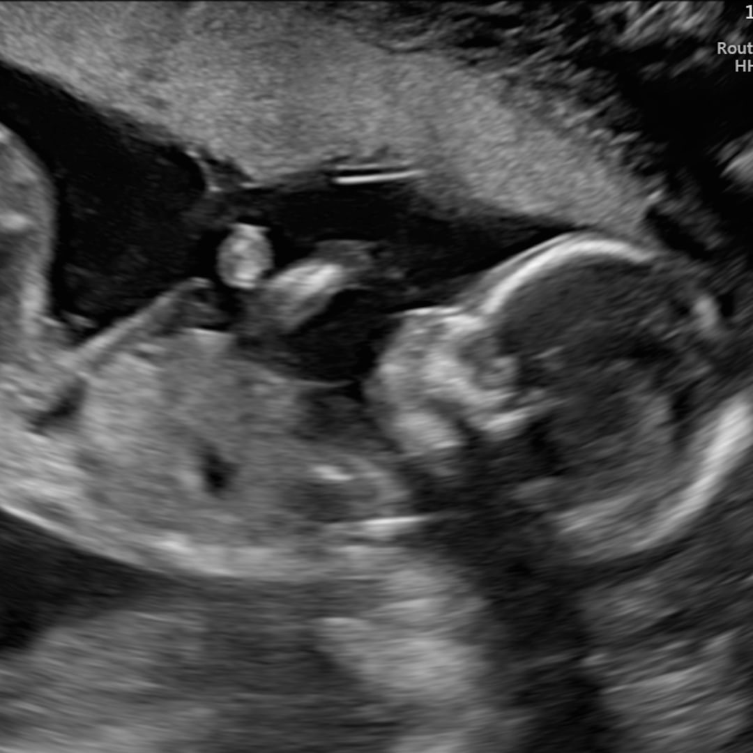 Photo shared by Jessica for their Babylist baby registry.