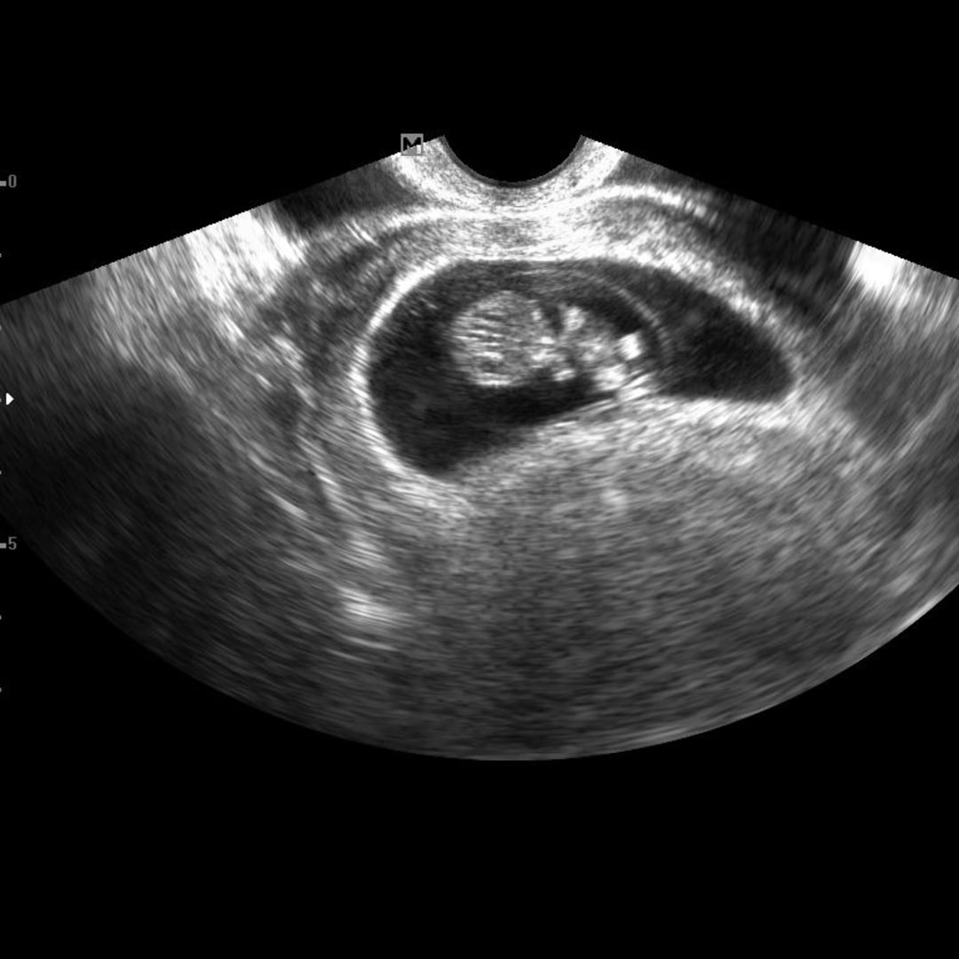 Photo shared by Bethany for their Babylist baby registry.