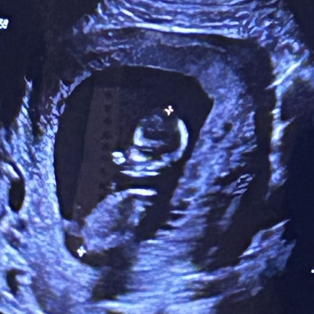 Photo shared by Amber for their Babylist baby registry.