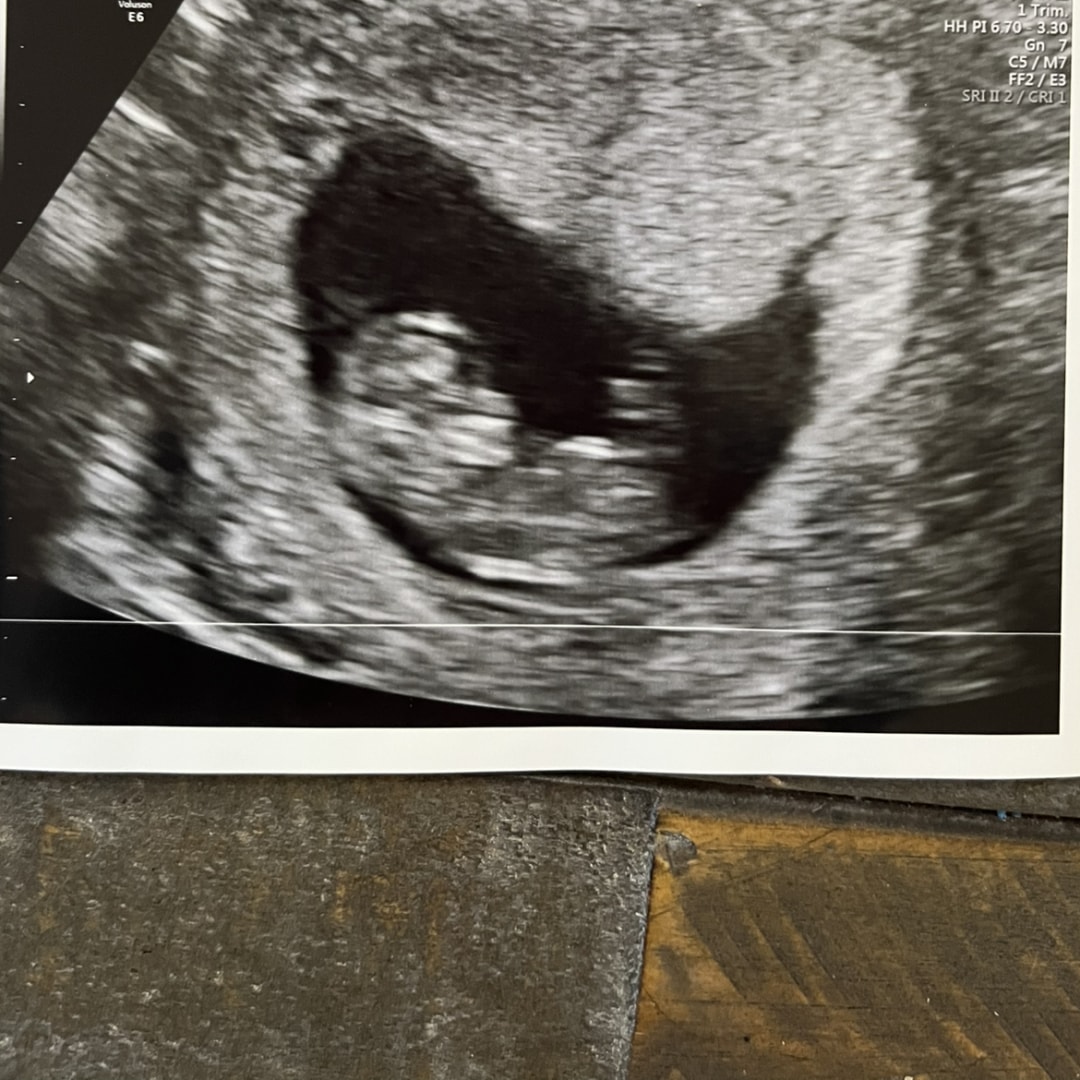 Photo shared by Emma for their Babylist baby registry.