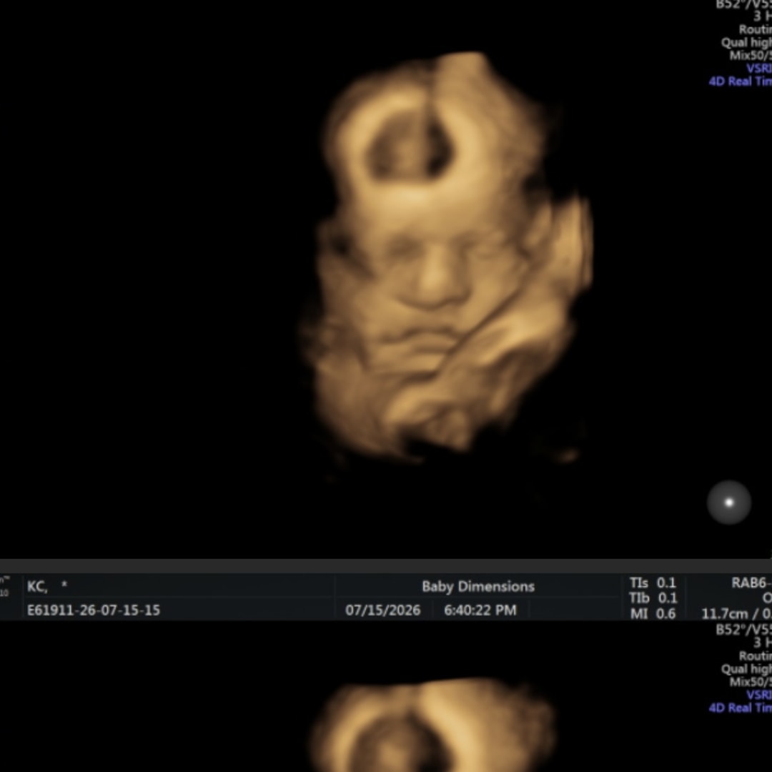 Photo shared by Kiera and Chase for their Babylist baby registry.