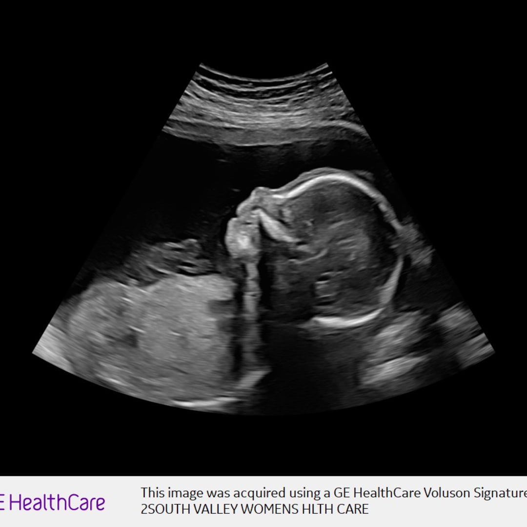 Photo shared by Katherine for their Babylist baby registry.