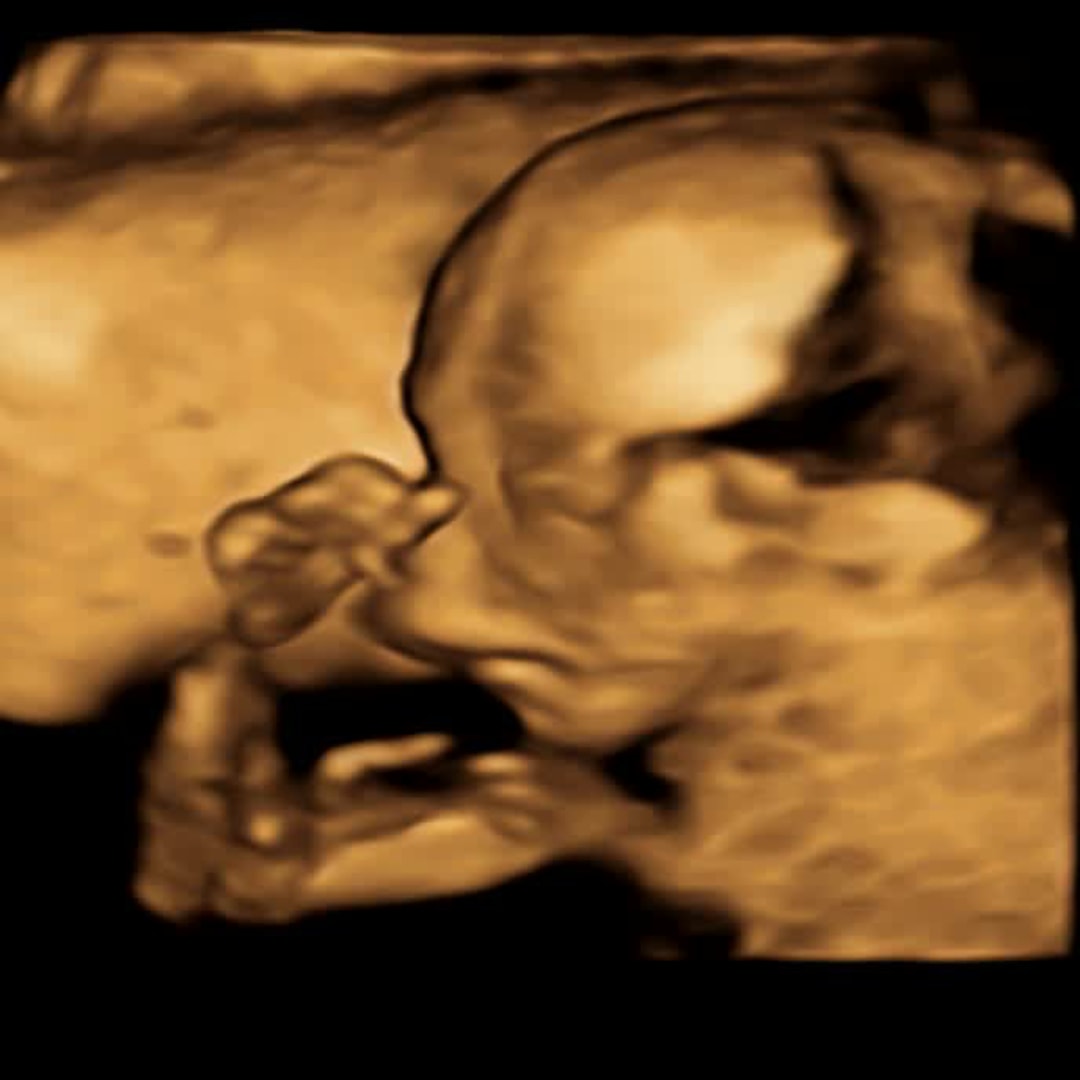 Photo shared by Flo for their Babylist baby registry.