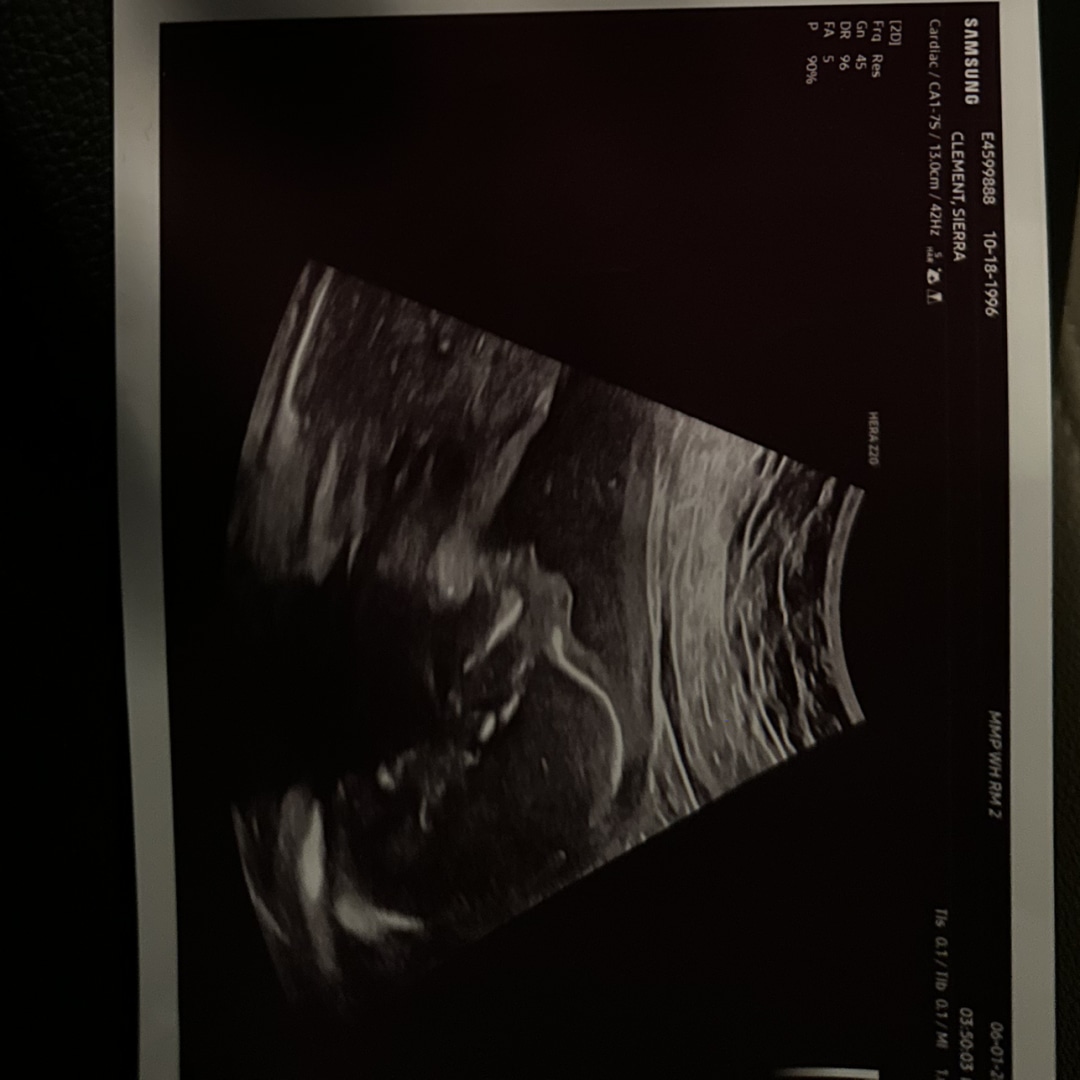 Photo shared by Sierra for their Babylist baby registry.