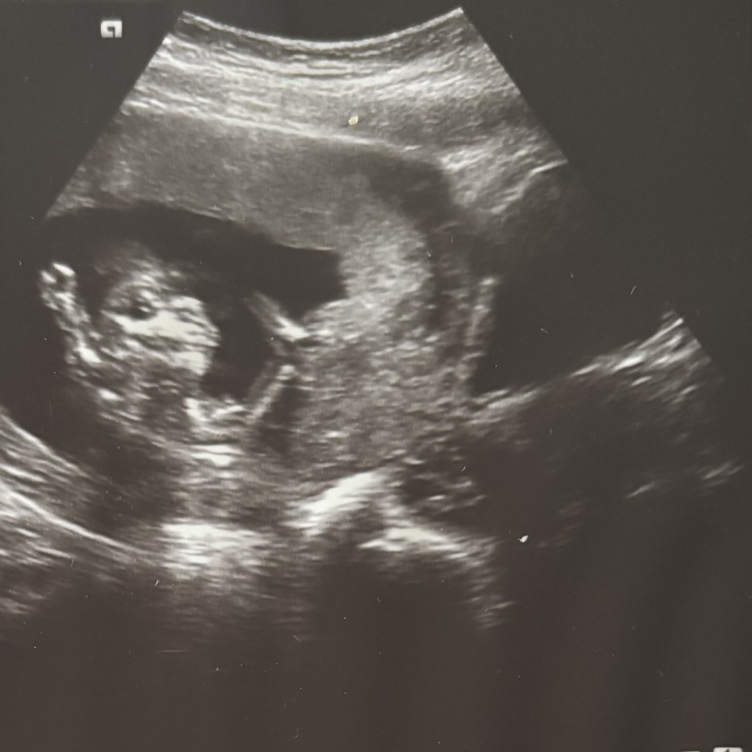 Photo shared by Elessa for their Babylist baby registry.