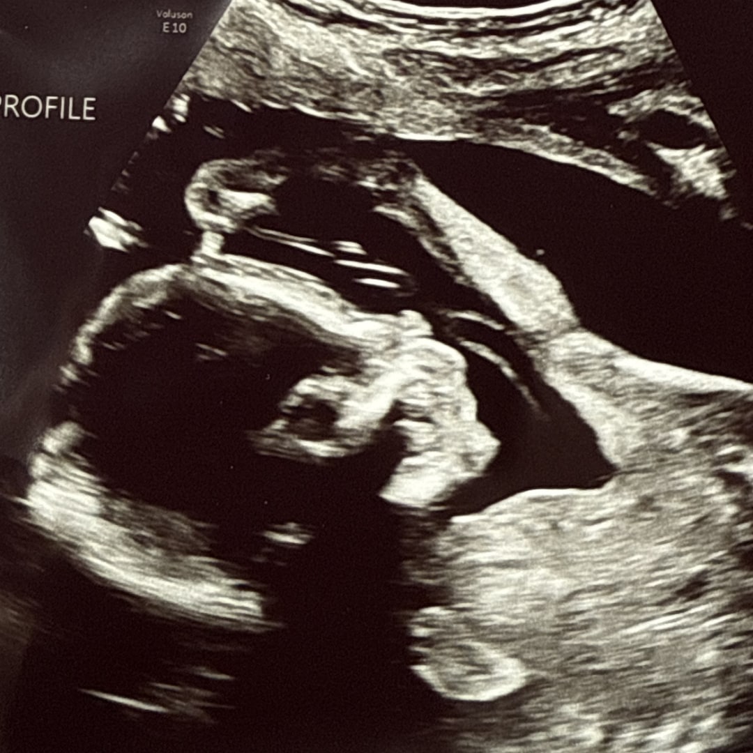 Photo shared by Kaitlin for their Babylist baby registry.