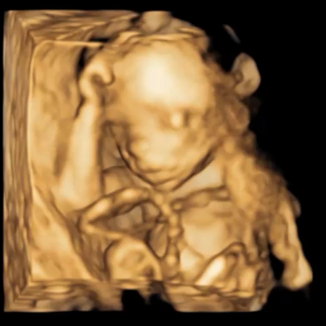 Photo shared by Andrea for their Babylist baby registry.