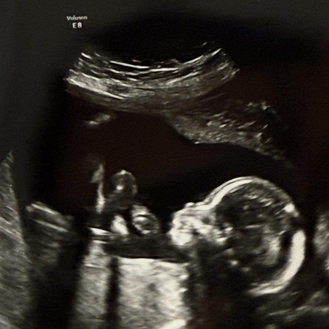 Photo shared by Yvonne for their Babylist baby registry.