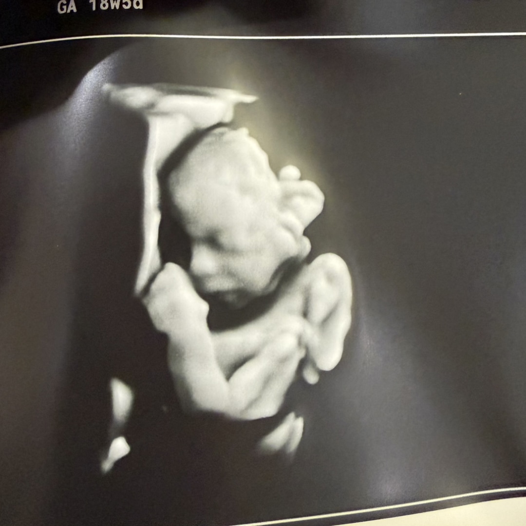 Photo shared by Abby for their Babylist baby registry.