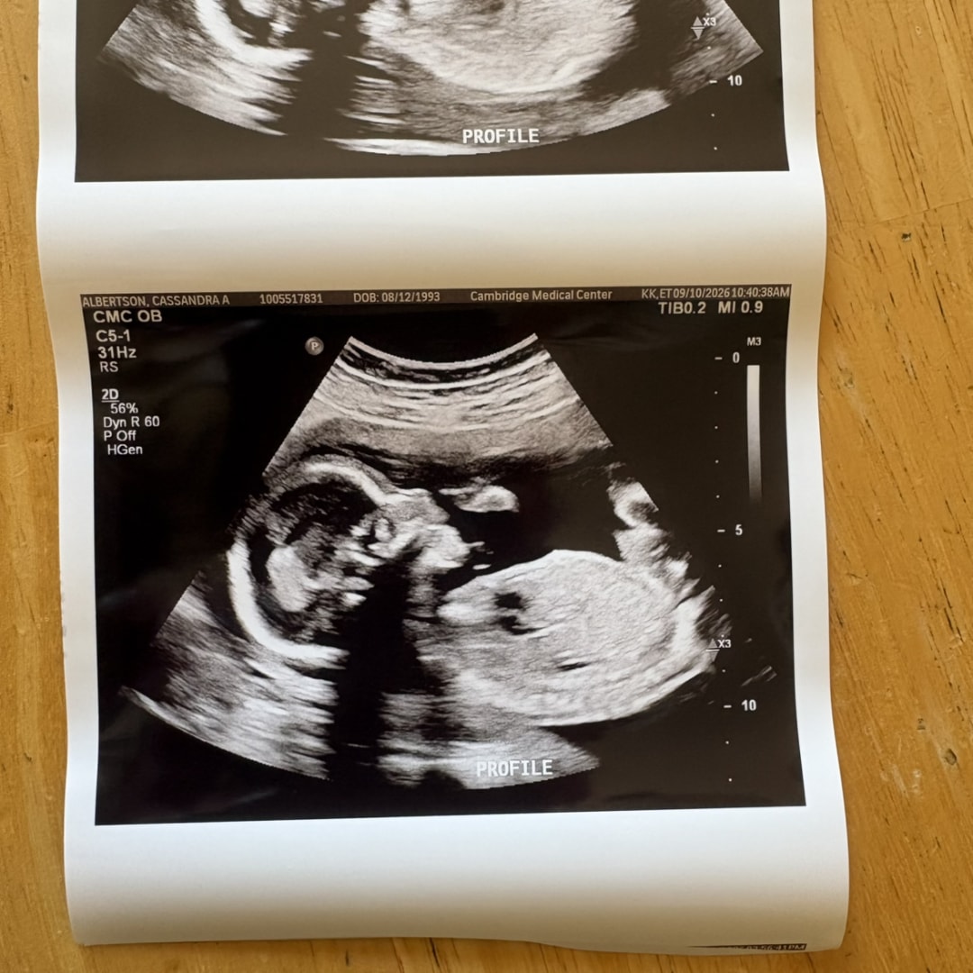 Photo shared by Cassandra for their Babylist baby registry.
