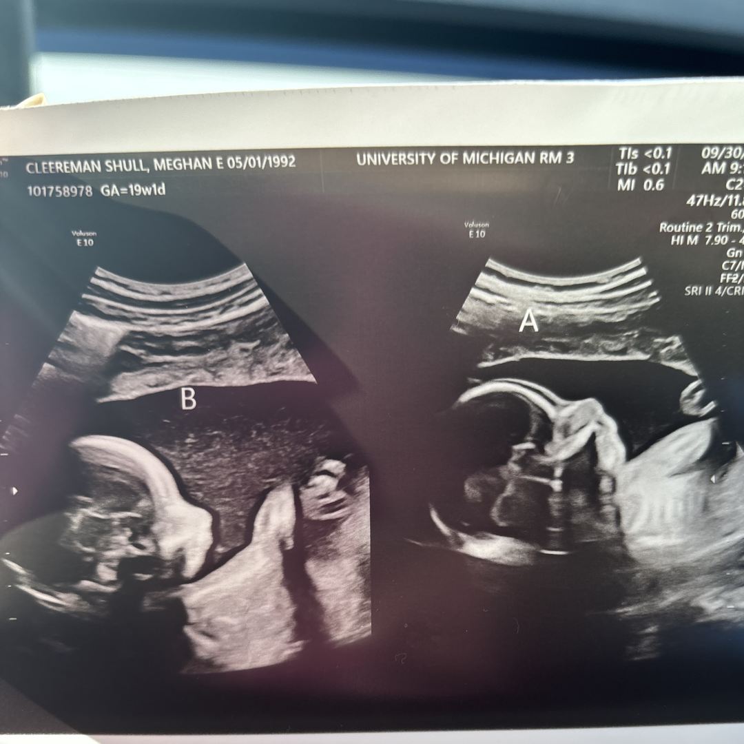 Photo shared by Meghan for their Babylist baby registry.