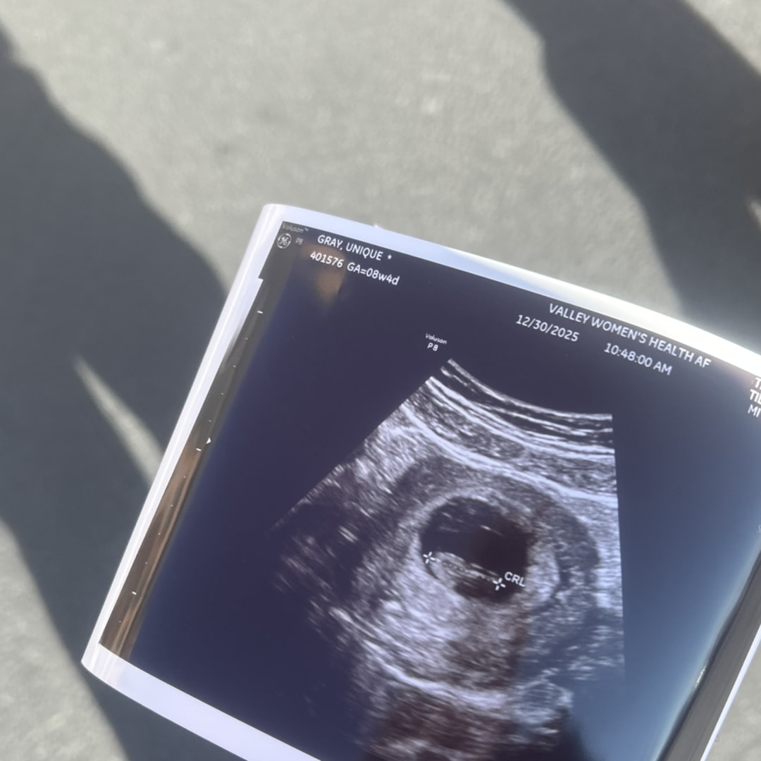 Photo shared by Unique for their Babylist baby registry.