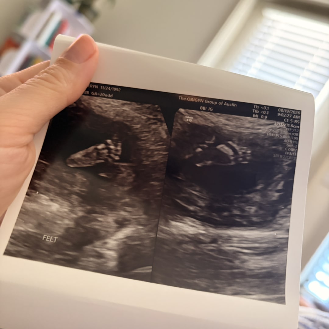 Photo shared by Eryn for their Babylist baby registry.