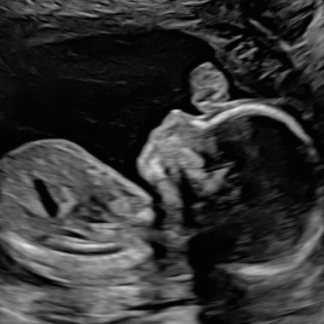 Photo shared by Anabel for their Babylist baby registry.