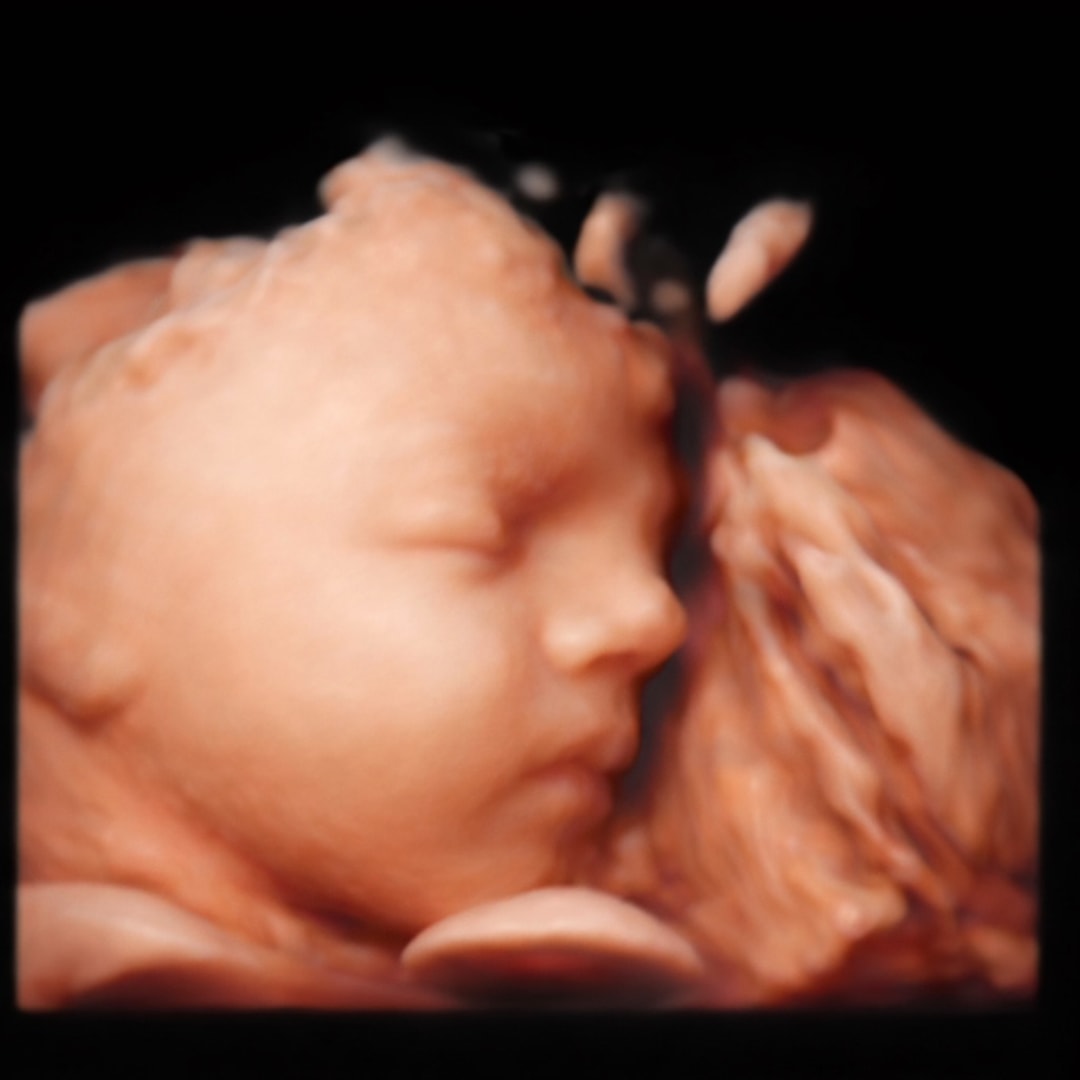 Photo shared by Emma for their Babylist baby registry.