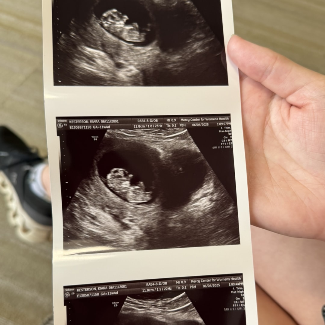 Photo shared by Kiara for their Babylist baby registry.