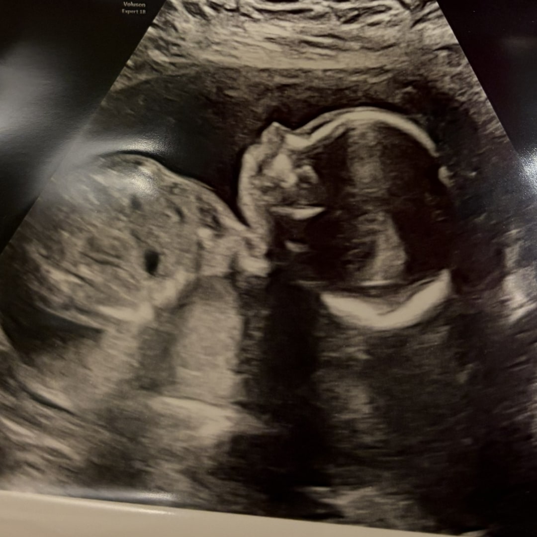 Photo shared by Claudia for their Babylist baby registry.