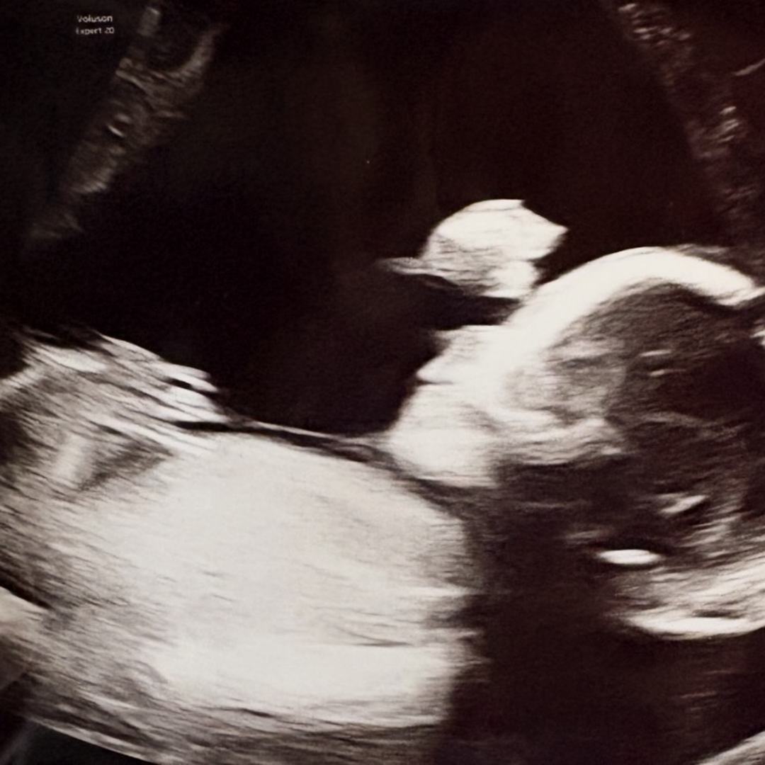 Photo shared by Morgan for their Babylist baby registry.