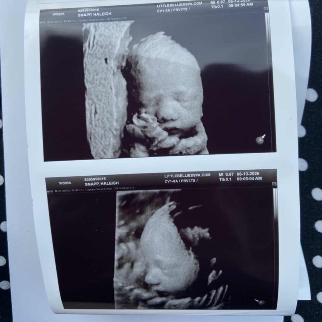 Photo shared by Haleigh for their Babylist baby registry.