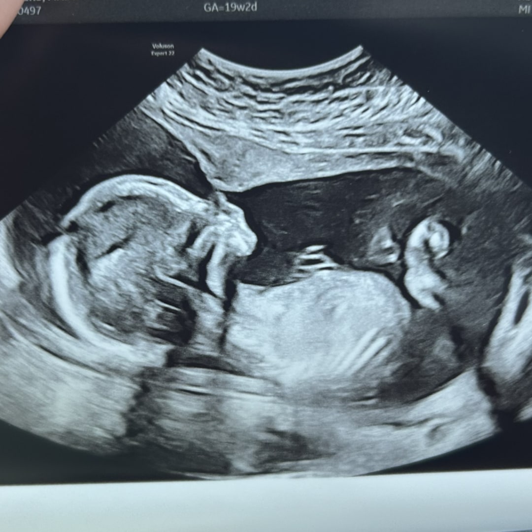 Photo shared by Madison for their Babylist baby registry.