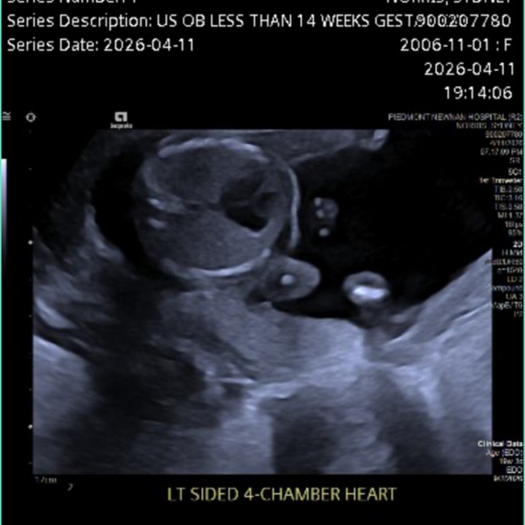 Photo shared by Sydney for their Babylist baby registry.