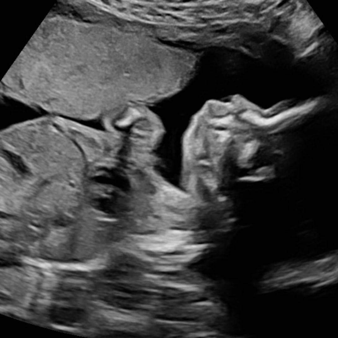 Photo shared by Kate for their Babylist baby registry.