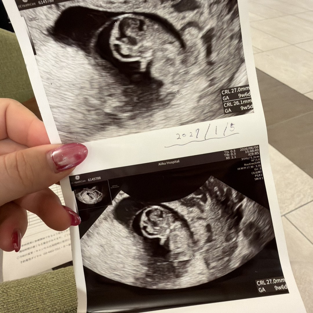 Photo shared by Cassie for their Babylist baby registry.