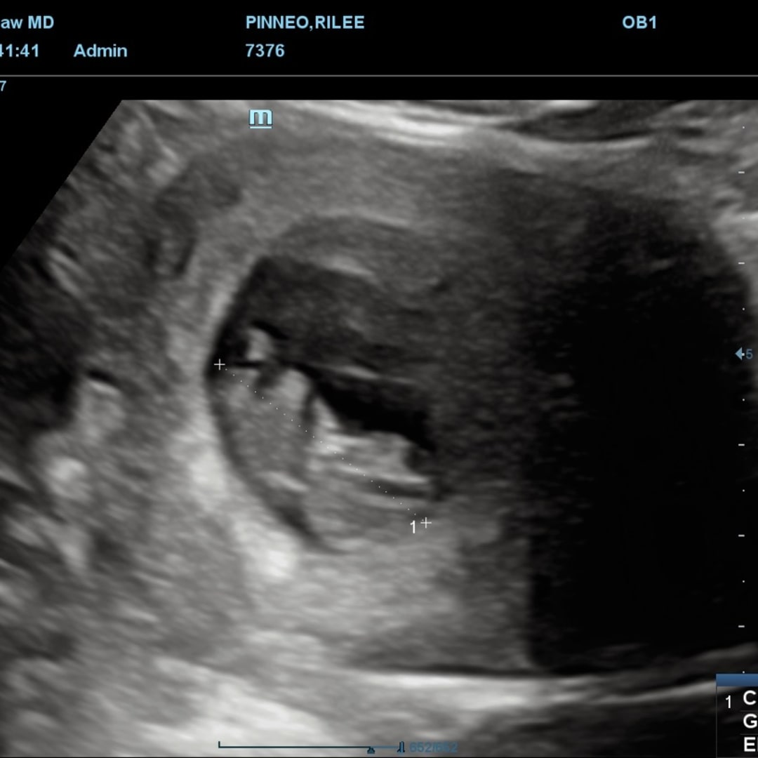 Photo shared by Rilee for their Babylist baby registry.