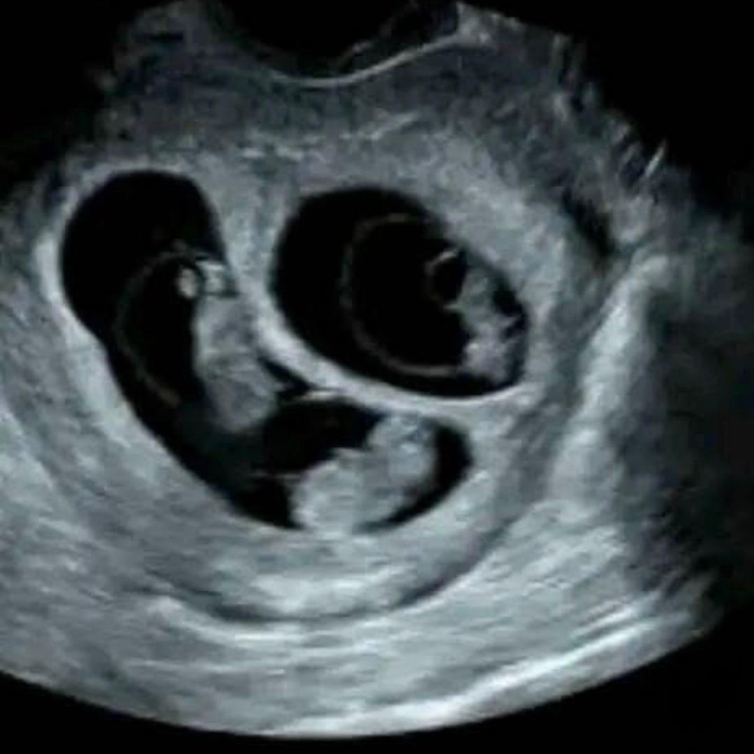 Photo shared by Heath & Pascal for their Babylist baby registry.