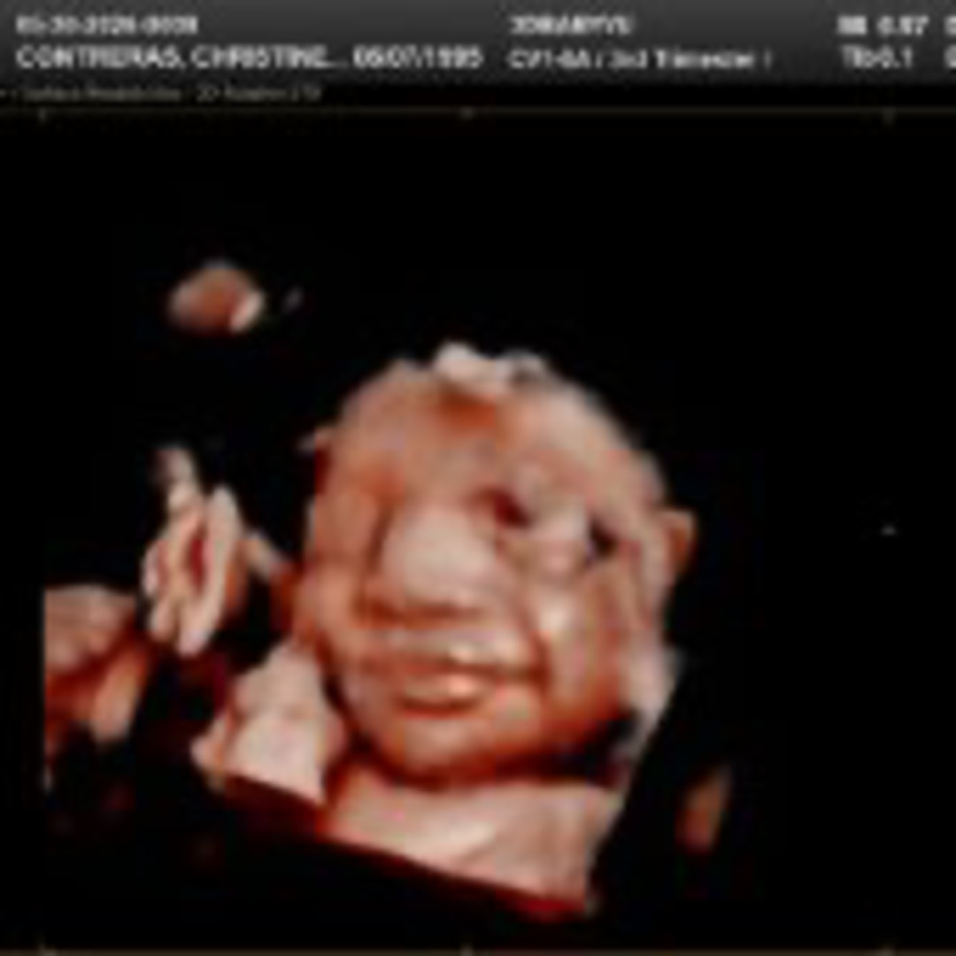 Photo shared by Christine Joy for their Babylist baby registry.