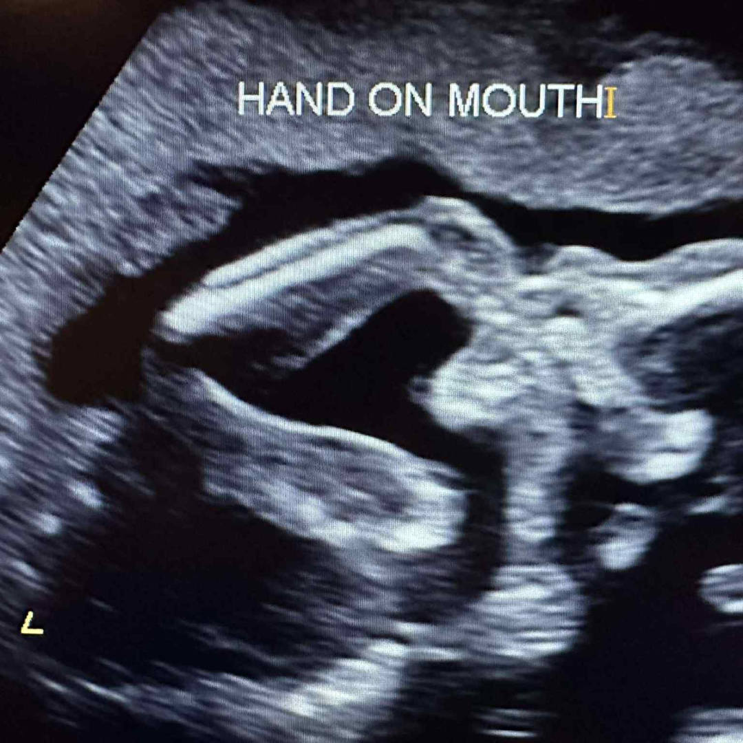 Photo shared by Keyawna for their Babylist baby registry.