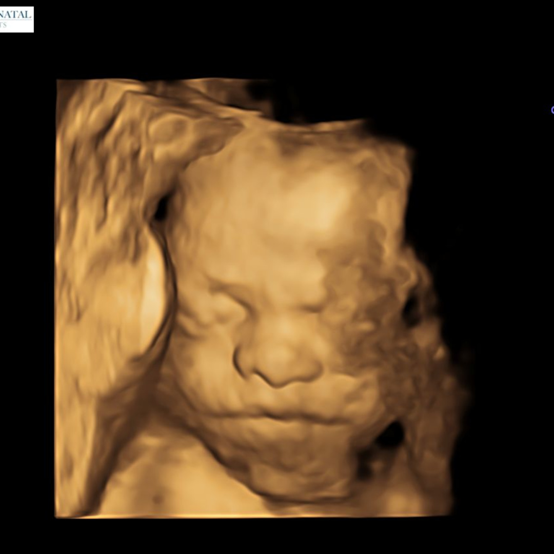 Photo shared by Selena for their Babylist baby registry.