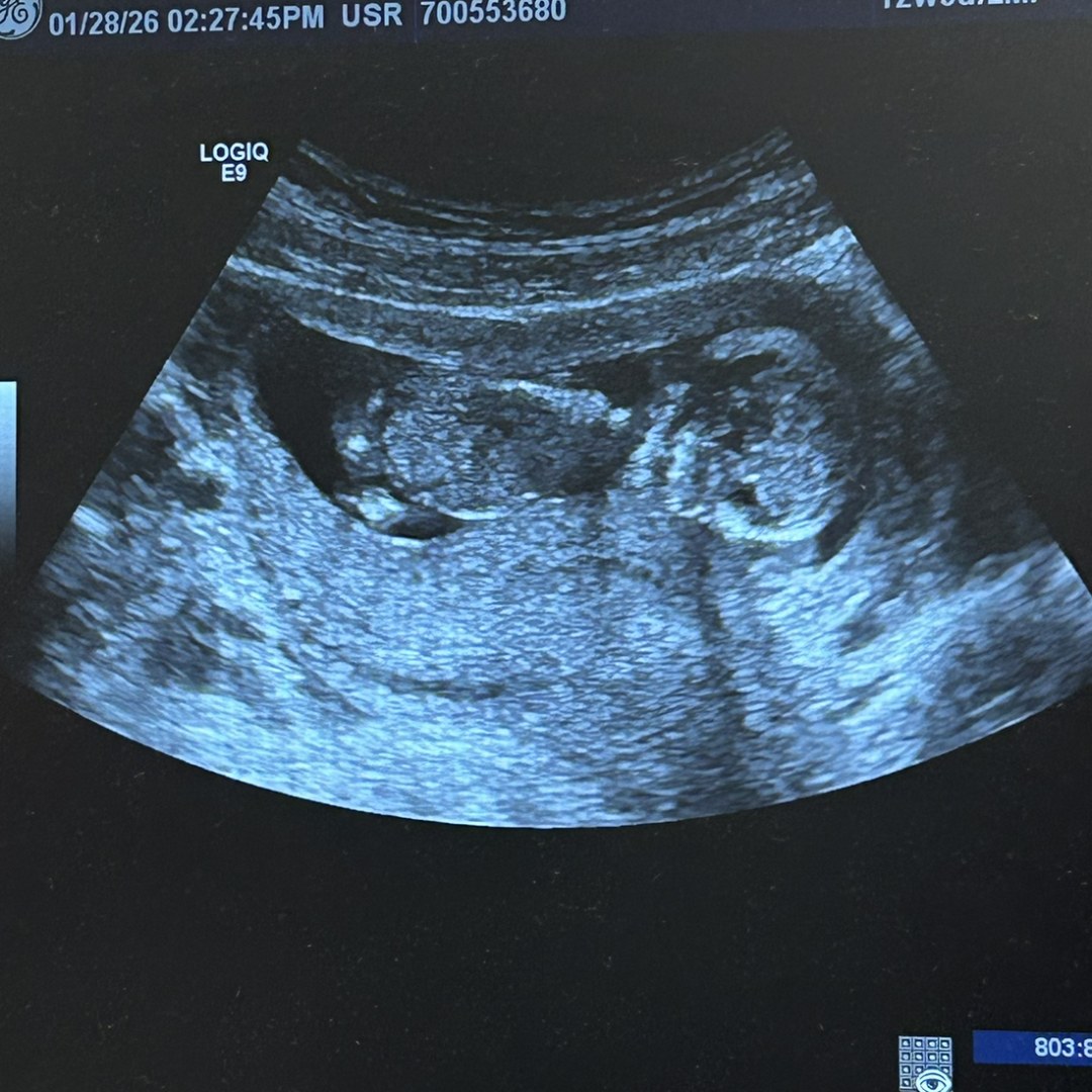 Photo shared by Jessica for their Babylist baby registry.