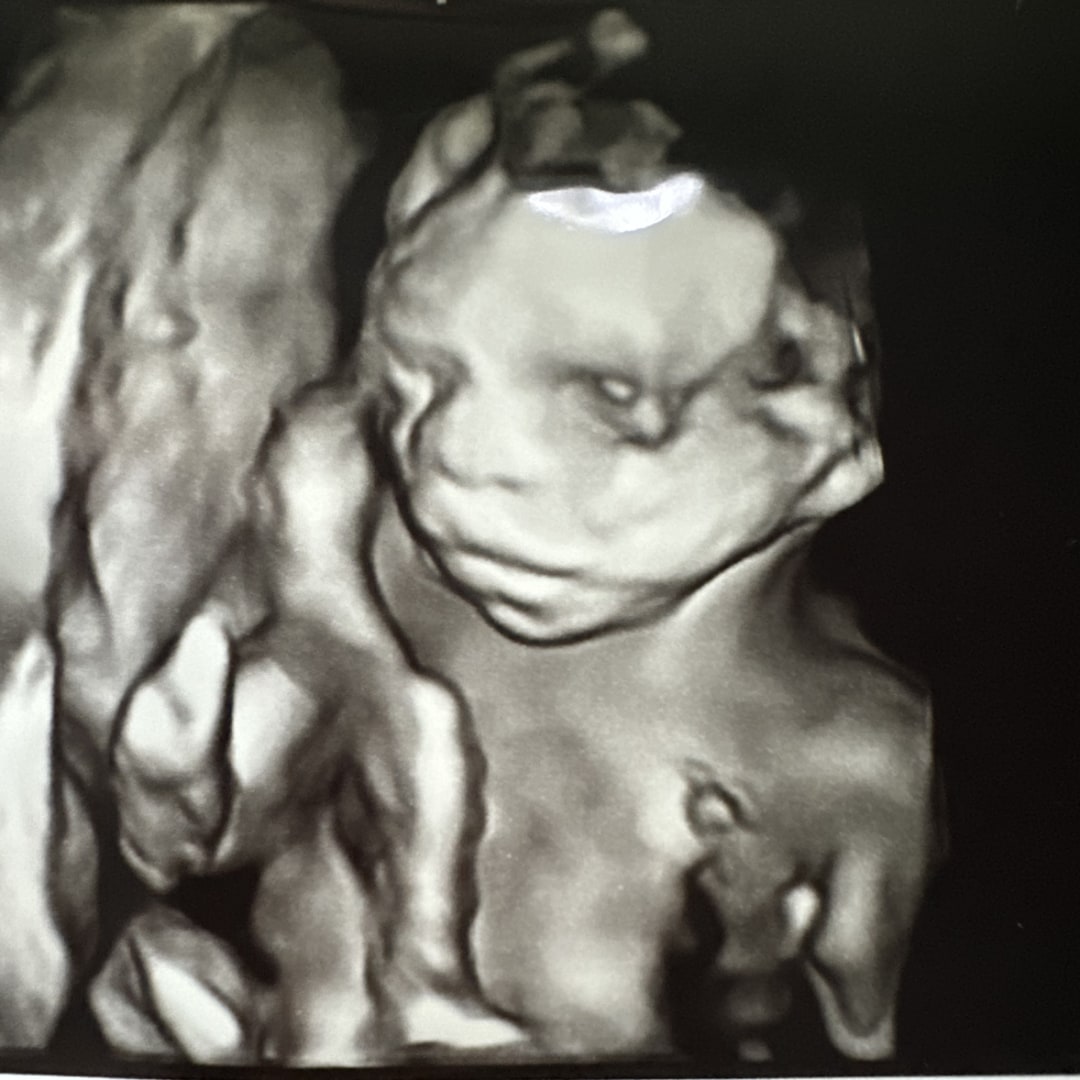 Photo shared by Ley for their Babylist baby registry.
