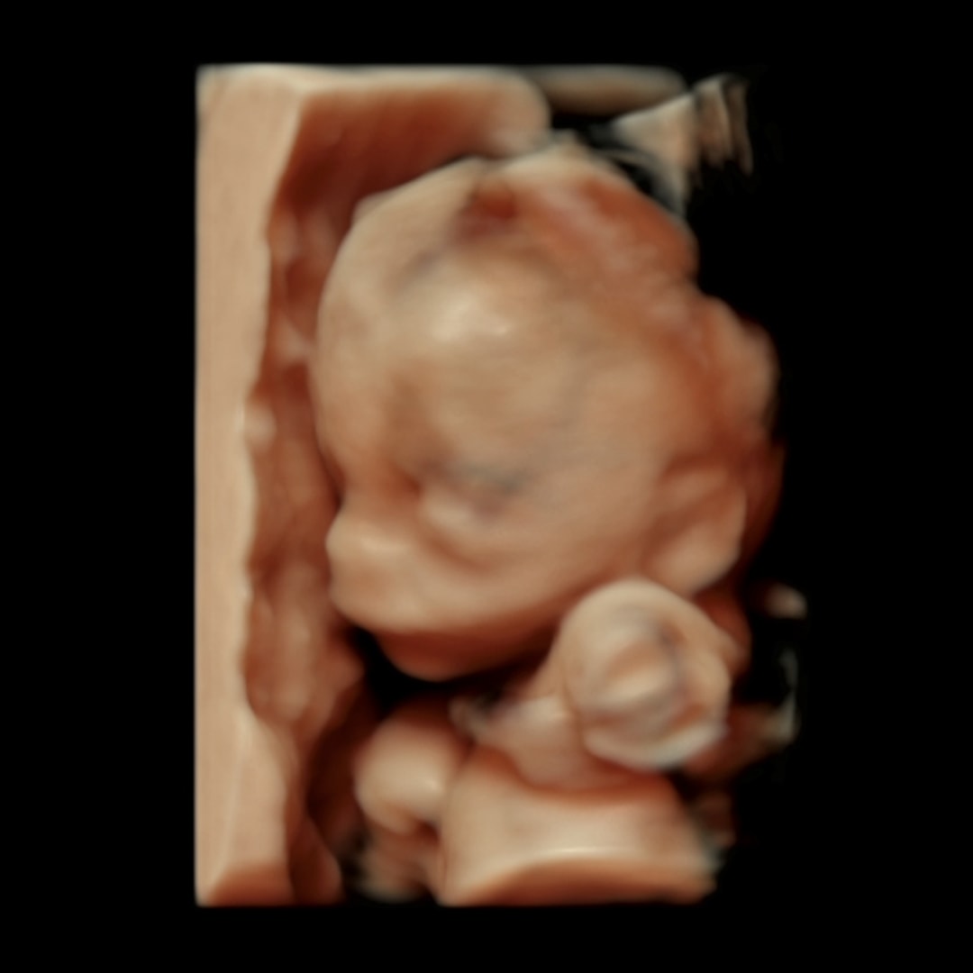 Photo shared by Emily for their Babylist baby registry.