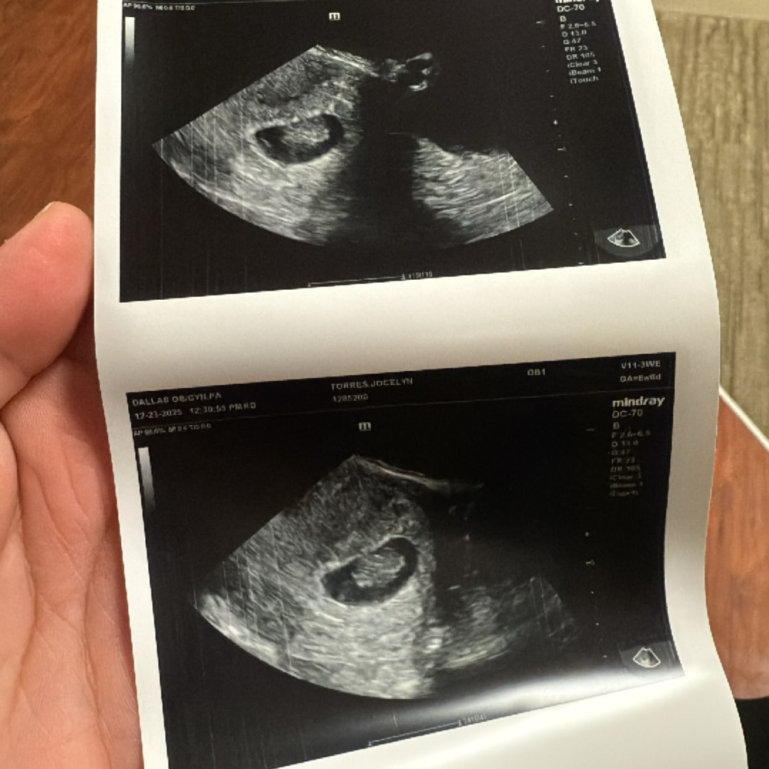 Photo shared by Jocelyn for their Babylist baby registry.