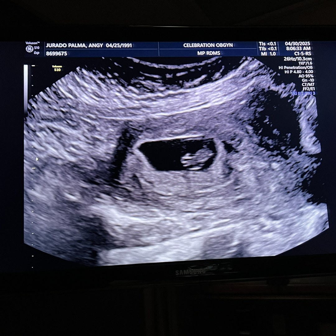 Photo shared by Angy for their Babylist baby registry.