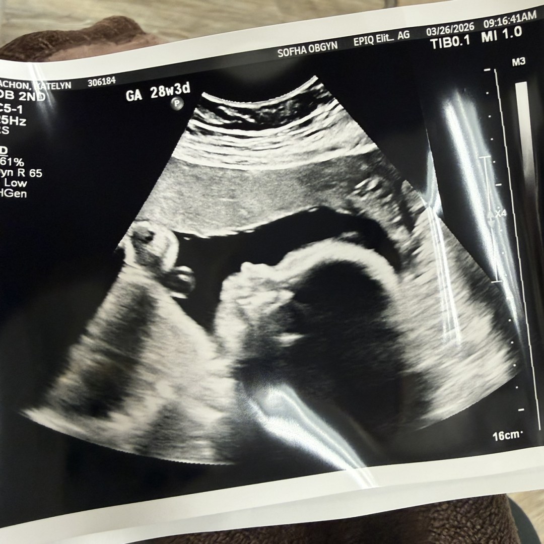 Photo shared by Katie for their Babylist baby registry.