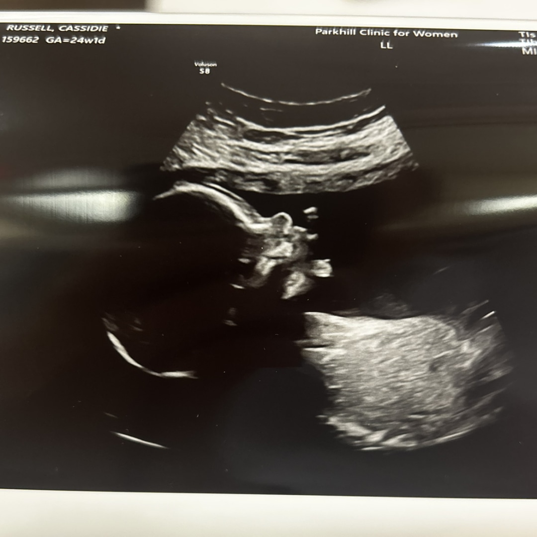 Photo shared by Cassidie for their Babylist baby registry.